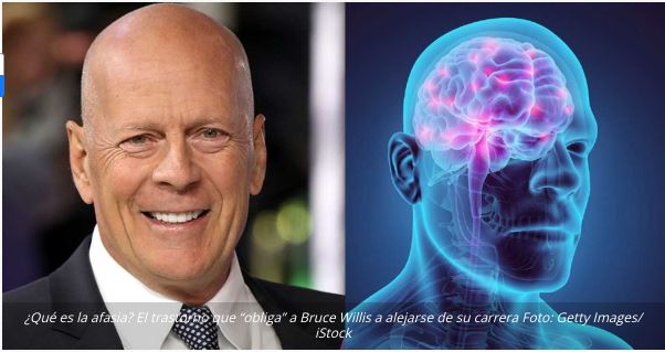 Die Hard: ¿Qué es la afasia que sufre Bruce Willis?
